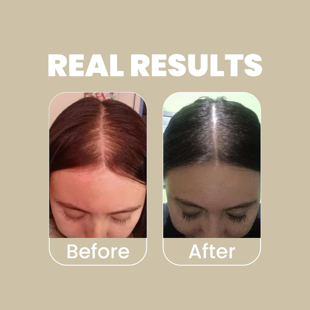 Rosemary Shampoo and Conditioner Set - with Hyaluronic Acid and Natural Extracts, Strengthens and Hydrates Hair for Shine and Vitality - ¡Tu Cabello Fuerte!