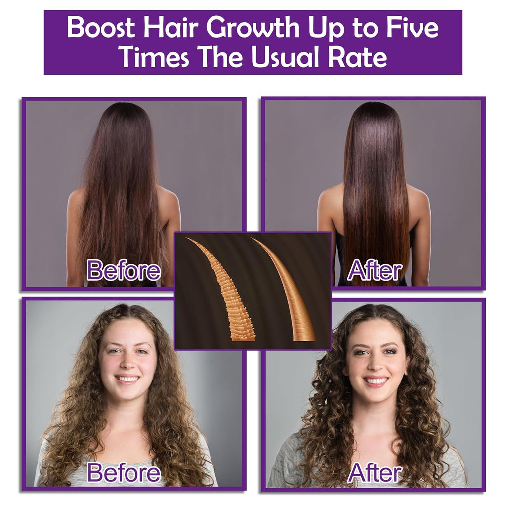 Hair Growth Shampoo and Conditioner Set W/Hair Growth Oil Serum Products,Biotin Argan Oil Castor Oil Routine Rosemary Shampoo for Thinning Hair Loss