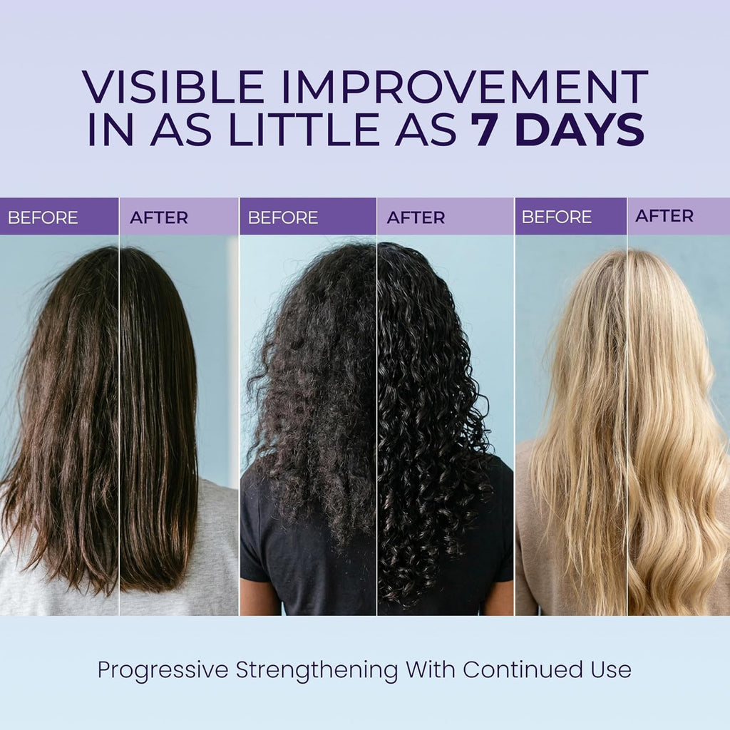 Biotin Shampoo & Conditioner Set for Longer Hair: Promotes Healthy Hair Growth, Strengthens Damaged Hair, Prevents Hair Breakage, Infused with Biotin - 10.1 FL OZ / 300 ML