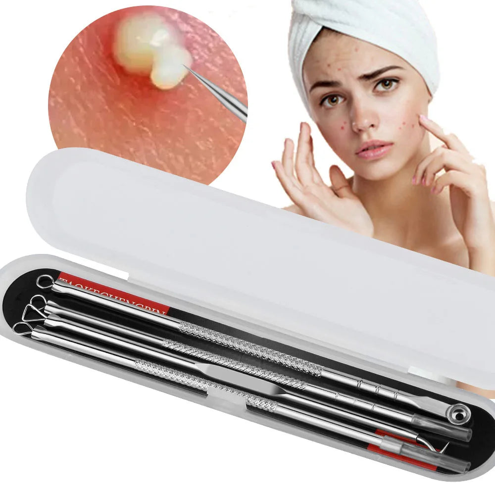 4Pc/Set Acne Blemish Remover Blackhead Extractor Black Dots Cleaner Needles Set Black Spots Pore Cleanser Tool